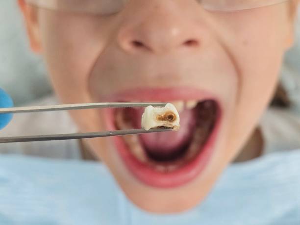 Best Emergency Pediatric Dental Care in Longbranch, WA